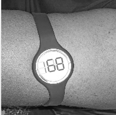 IIT Madras Researchers develop Affordable, Minimally Invasive Glucose Monitoring Device for Diabetes Patients